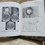 Beckers- Shaffer's Diagnosis And Therapy Of The Glaucomas. By Allan E. Kolker & John Hetherington,jr. Large Volume Hardback In Good Condition. See Photos For Same. Image 10