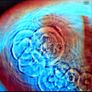 Pink Floyd - Meddle, Vinyl, LP, Remastered, RE Image 3