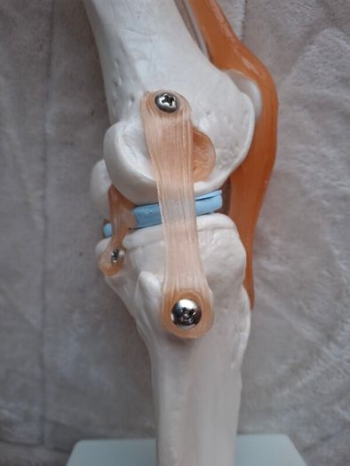 Life Size Flexible Knee Joint Anatomical Model Skelton Functional Ligament Medical Model in Perfect Condition