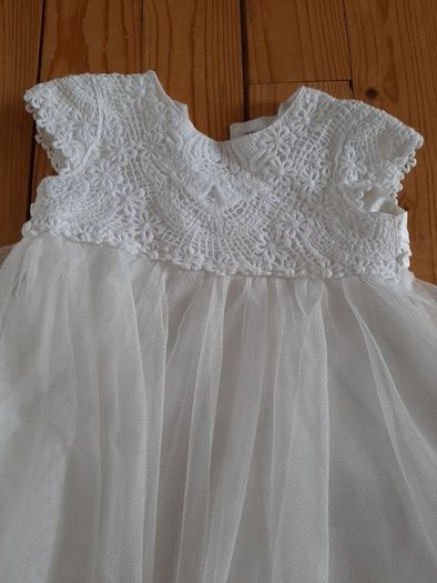 baby dress