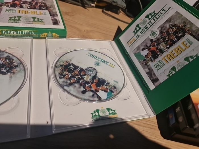 This Is How It Feels DVD