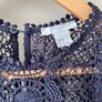 H&M lace Dress Image 5