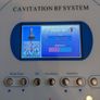 Cavitation and RF machine Image 5