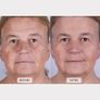 Led Face Mask (brand New) Image 7