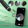 VITCOCO Ear Wax Removal Kit Ear Camera 1920P HD Ear Wax Removal Tool Ear Cleaner Otoscope with 6 LED Lights, 3mm Visual Ear Scope for iPhone iPad Android Image 5