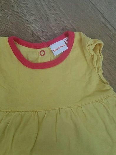 baby dress