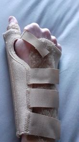 Wrist Support for Fractured Scaphoid Bone