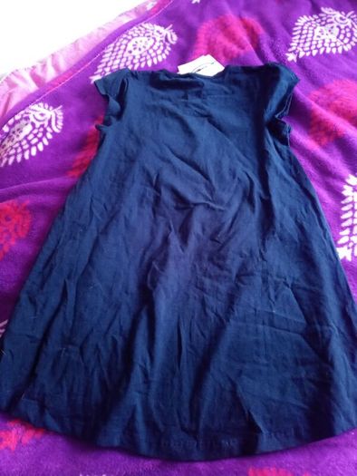 Name it pineapple tunic dress, aged 10