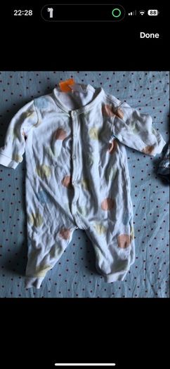 14 Footless baby grows.