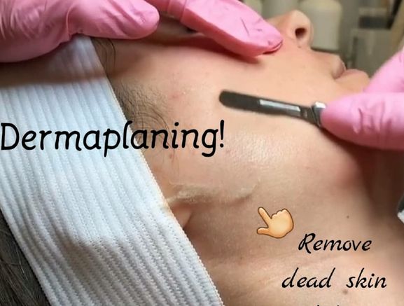 Dermaplaning