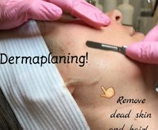 Dermaplaning