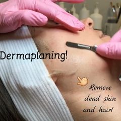 Dermaplaning