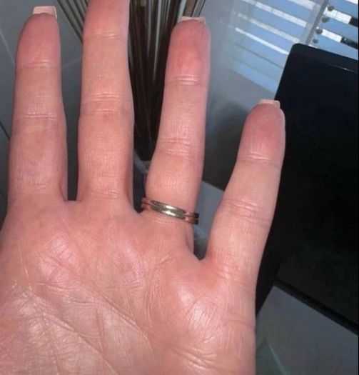 Ring Set