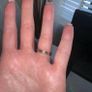 Ring Set Image 6