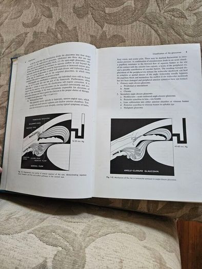 Beckers- Shaffer's Diagnosis And Therapy Of The Glaucomas. By Allan E. Kolker & John Hetherington,jr. Large Volume Hardback In Good Condition. See Photos For Same.