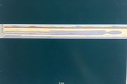 The Alan Parsons Project 12" Vinyl