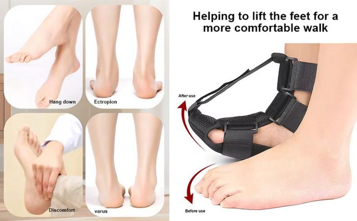 Night Foot Splint - Adjustable Support Sock for Plantar Fascia and Achilles Tendon Comfort