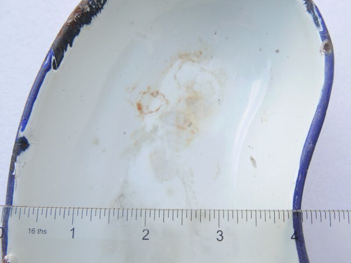 Vintage Enamel Medical Tray: Distressed Kidney-Shaped Metal Basin